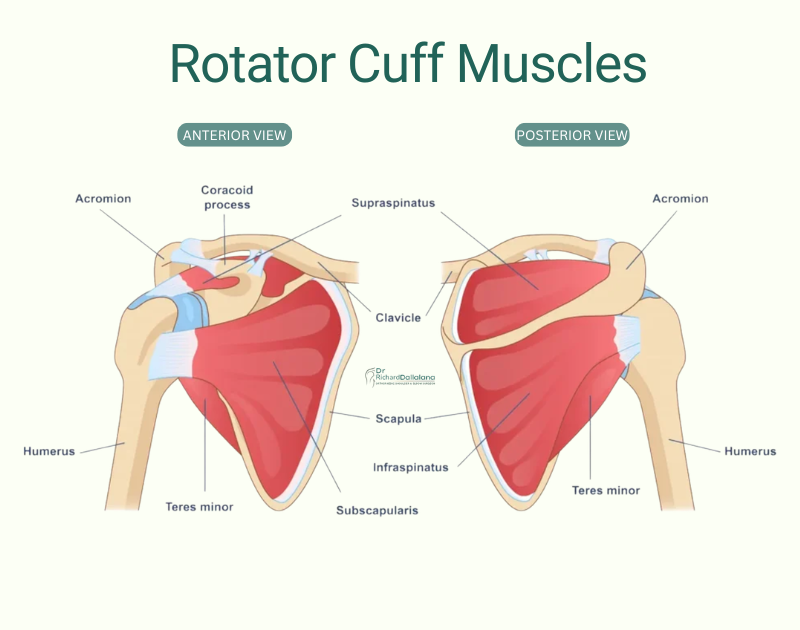 _Rotator cuff tear_infraspinatus